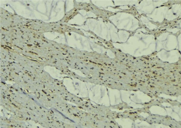 MURF1 / IRF Antibody