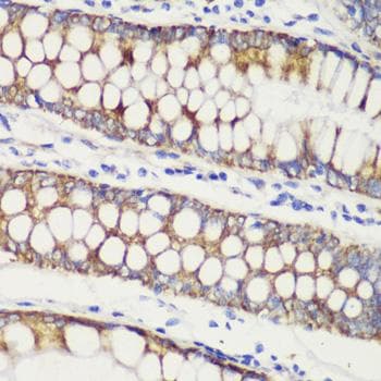 Polyclonal Rabbit anti-Human TOMM20 Antibody (IHC, IF)