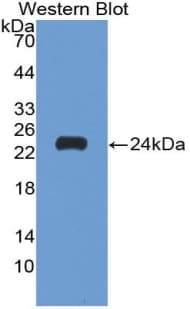 MMP9 / Gelatinase B Antibody (aa213-399, APC)