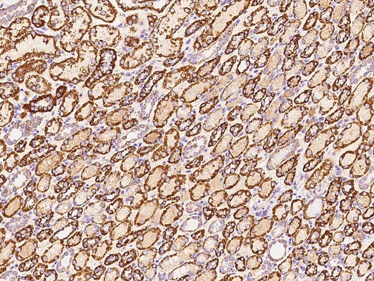 Polyclonal Rabbit anti-Human ATP5B / ATP Synthase Beta Antibody (Preservative Free, IHC, WB)