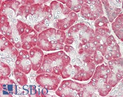 IHC-plus™ Polyclonal Rabbit anti-Human IL12A / p35 Antibody (Internal, IHC, WB)