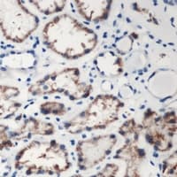 Polyclonal Rabbit anti-Human DMGDH Antibody (C-Terminus, IHC, WB)
