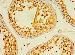 EDA2R / XEDAR Antibody (aa1-138)