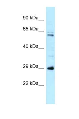 Polyclonal Rabbit anti-Human HSD17B8 / RING2 Antibody (aa51-100, WB)