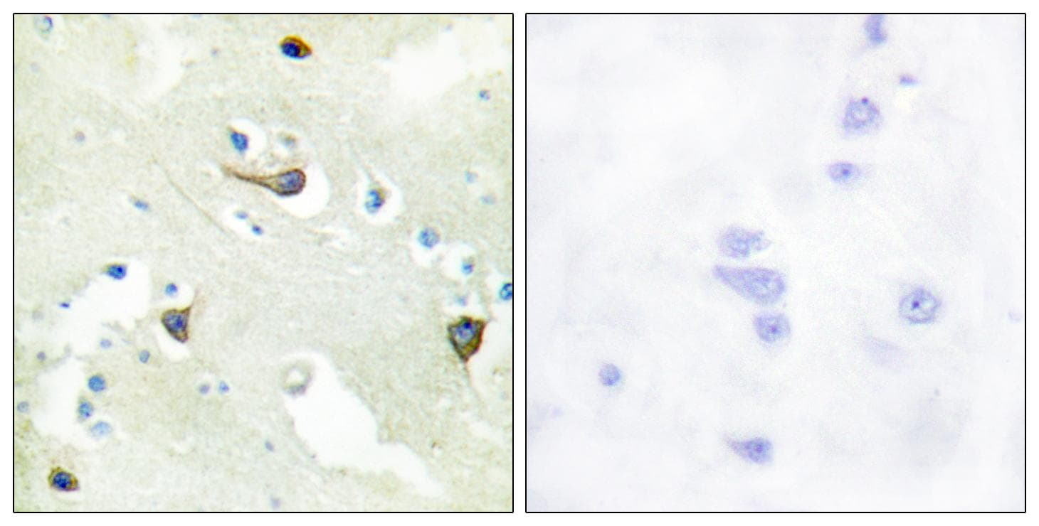 EPH Receptor B1+B2+B3 Antibody