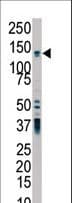 PKD2 / Polycystin 2 Antibody (aa937-968)