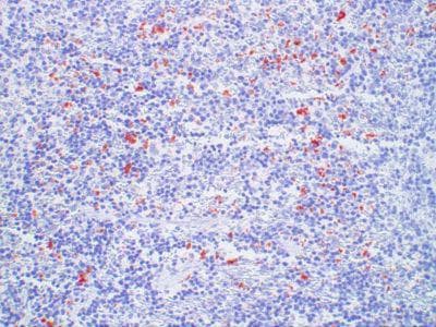 CHEMR23 / CMKLR1 Antibody (clone 1G10)
