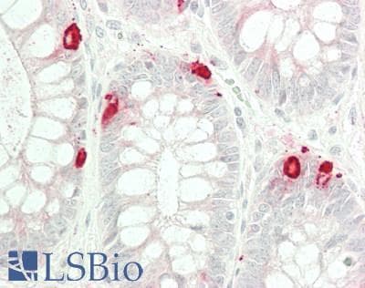 PathPlus™ CHGA / Chromogranin A Antibody (aa19-457)