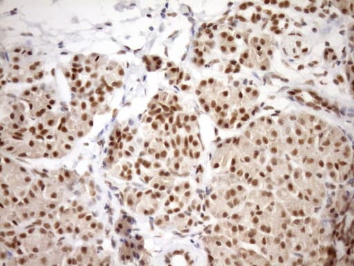 Monoclonal Mouse anti-Human SYF2 / p29 Antibody (clone OTI6A5, aa2-92, IHC, WB)