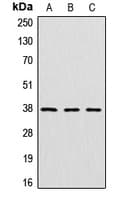 PathPlus™ CTSV / Cathepsin V Antibody (Internal)