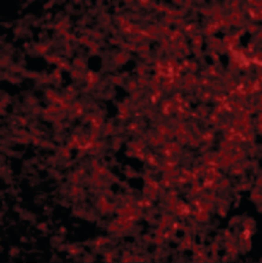IHC-plus™ PSEN1 / Presenilin 1 Antibody