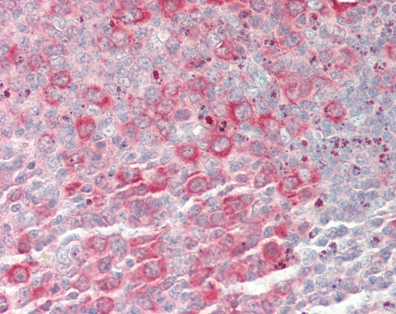 CAD Antibody (N-Terminus)
