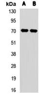 COT / CROT Antibody