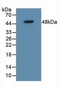 IL5RA / CD125 Antibody (aa42-182)