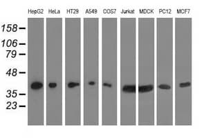 HIBCH Antibody (clone OTI4G1)
