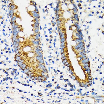 Polyclonal Rabbit anti-Human HSPA9 / Mortalin / GRP75 Antibody (IHC, IF, WB)