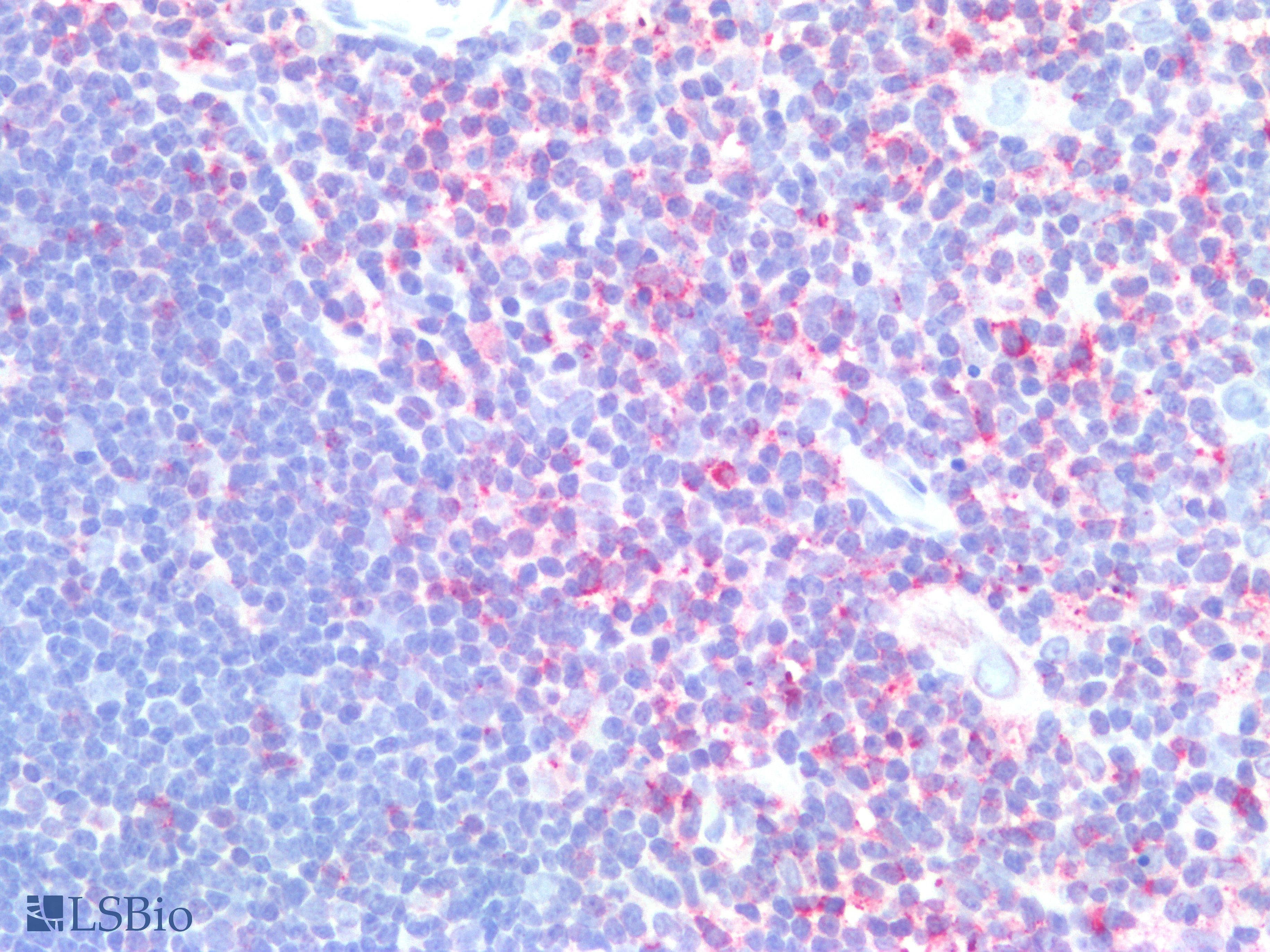 PathPlus™ Polyclonal Rabbit anti-Human PDCD1 / CD279 / PD-1 Antibody (Internal, IHC, WB)