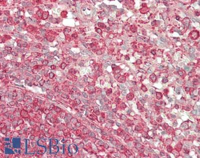 IHC-plus™ ACTB / Beta Actin Antibody (N-Terminus)