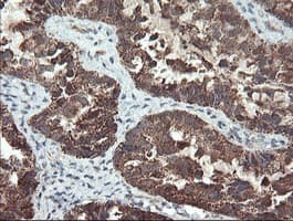 UBE2E3 Antibody (clone OTI6D3)