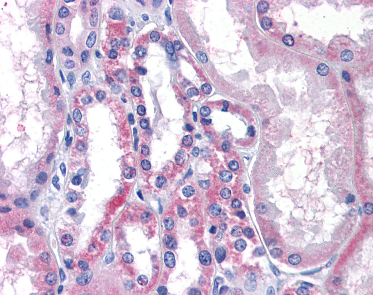 IHC-plus™ Polyclonal Rabbit anti-Human LPCAT1 / AYTL2 Antibody (Internal, IHC)