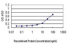 IL13RA1 / IL13R Alpha 1 Antibody (clone 1F5)