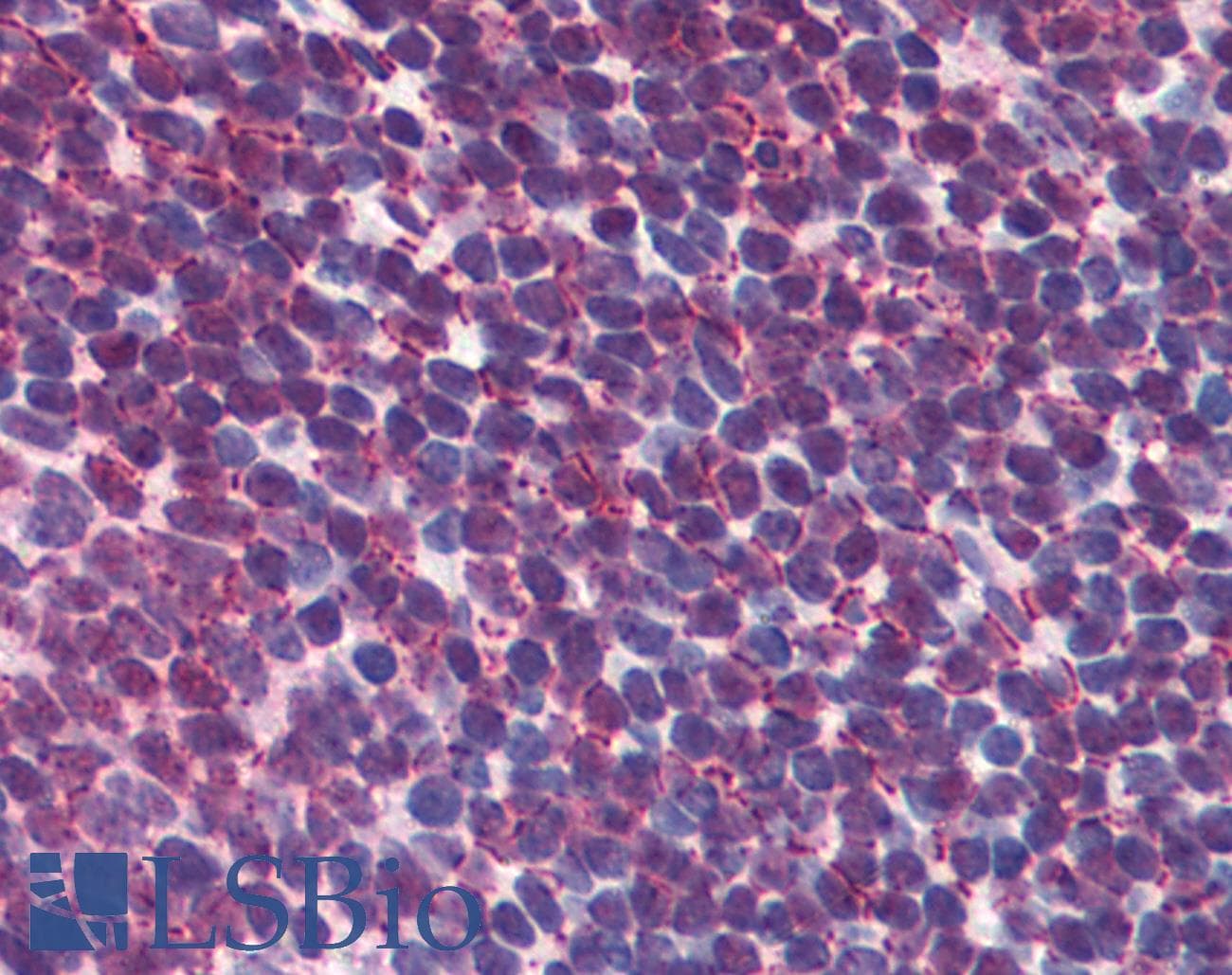 IHC-plus™ CREB1 / CREB Antibody (clone 3F1-1B2)