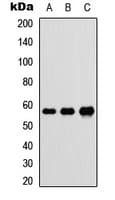 DNAJC3 / p58IPK Antibody (Internal)