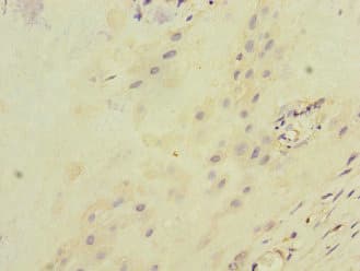 ITGB8 / Integrin Beta 8 Antibody