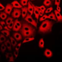 CAPN5 / Calpain 5 Antibody