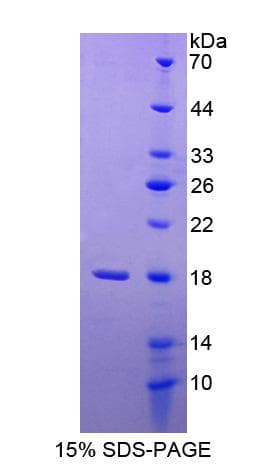 Human MAN2B1 / LAMAN Protein (Recombinant His-S)