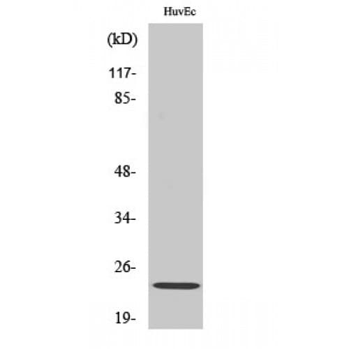 Polyclonal Rabbit anti-Human CAV1 / Caveolin 1 Antibody (100-180 aa, C-terminal, IF, WB)