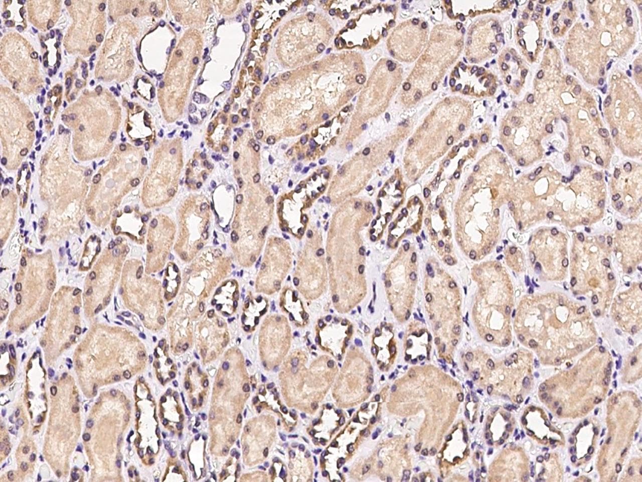 Polyclonal Rabbit anti-Human FUT4 / CD15 Antibody (IHC)