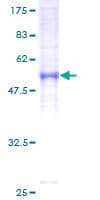 Human PRKACB Protein (Recombinant GST)