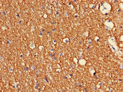 CDK5 Antibody (aa1-292)