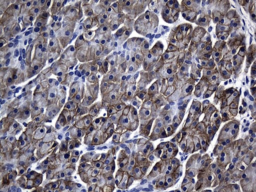 Monoclonal Mouse anti-Human SLC39A5 / ZIP5 Antibody (clone OTI2F2, aa48-178, IHC, WB)