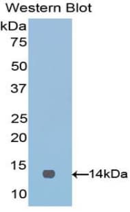 VTCN1 / B7-H4 Antibody (aa34-147, Cy3)
