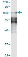 Monoclonal Mouse anti-Human DSC2 / Desmocollin 2 Antibody (clone 1F2, WB)
