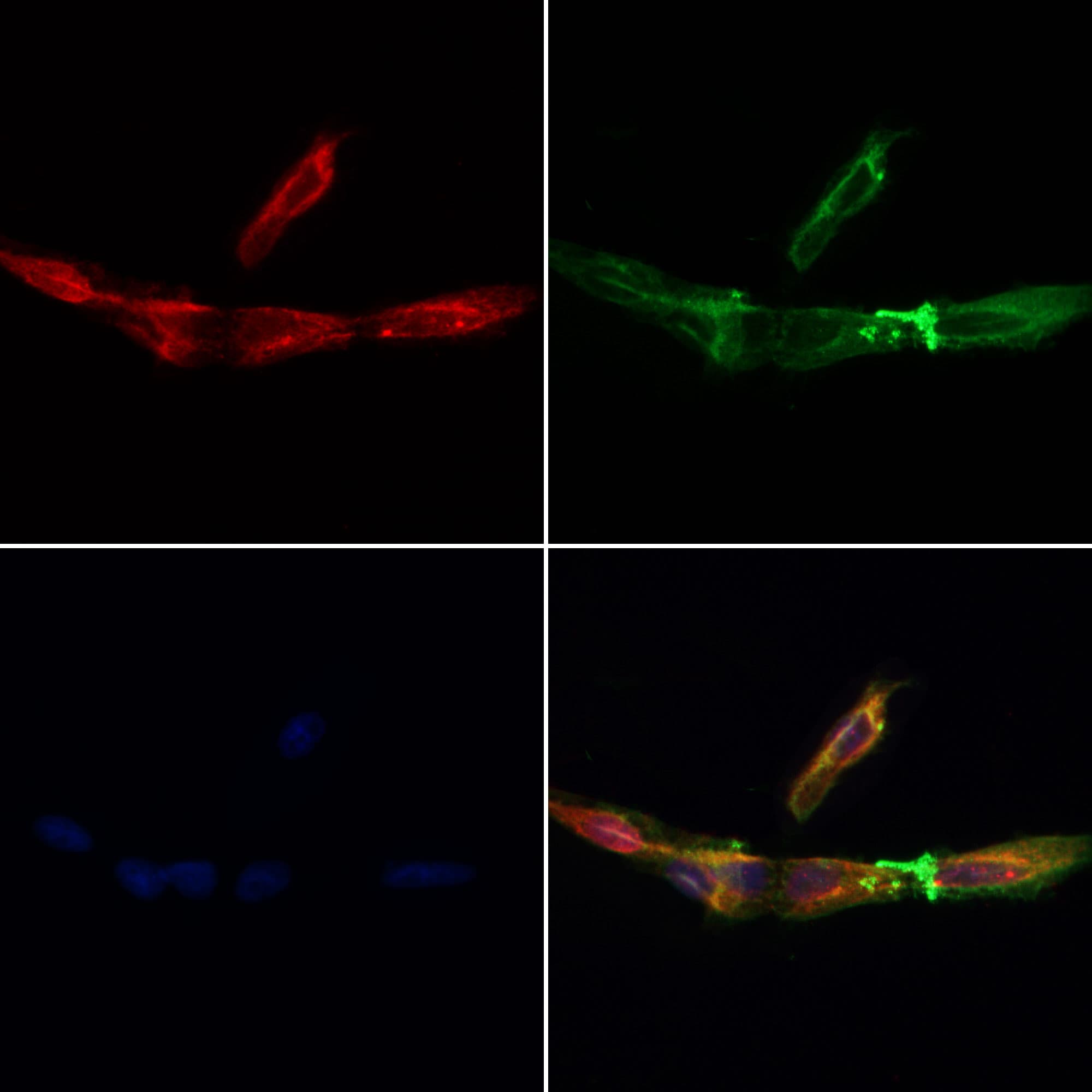 COA7 / SELRC1 Antibody