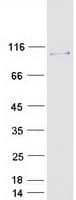 Human MCC Protein (Recombinant Myc-DDK (Flag))