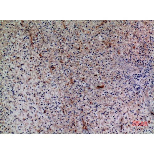 Polyclonal Rabbit anti-Human CXCR6 Antibody (1-50 aa, N-terminal, IHC, WB)