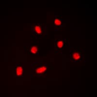 Polyclonal Rabbit anti-Human BAF53 / ACTL6A Antibody (Internal, IHC, IF, WB)