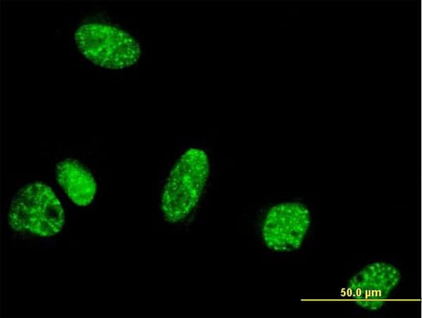 PPIG / Cyclophilin G Antibody (clone 4F8)