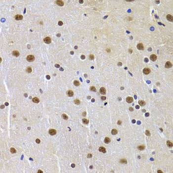 PPP1R8 / Rnase E Antibody