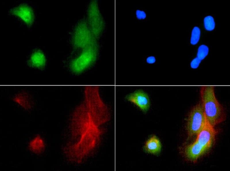 ABCB5 Antibody (Biotin)