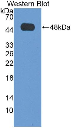 VPS37A Antibody