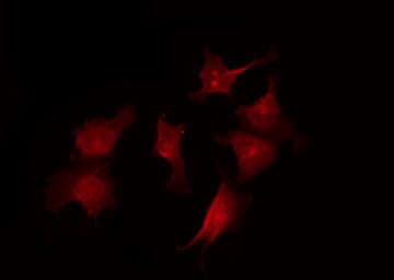 CDKN1B / p27 Kip1 Antibody (phospho-Ser10)