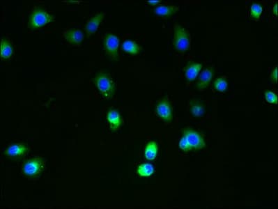 Polyclonal Rabbit anti-Human SLC35B4 Antibody