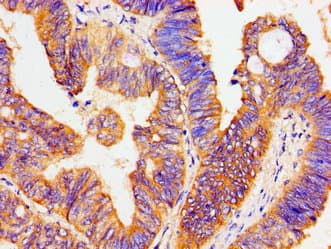 ATP1B1 Antibody