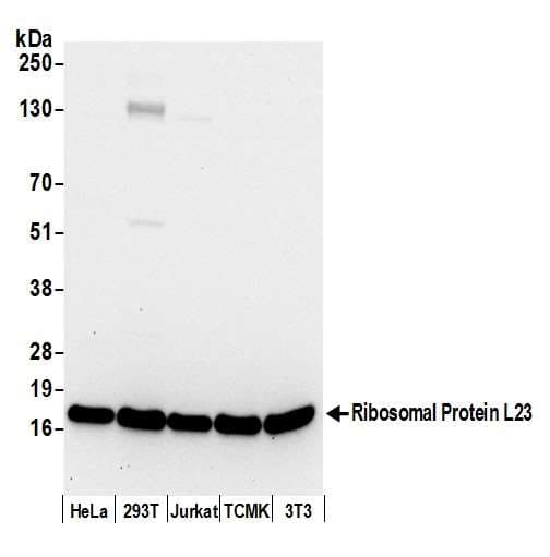 Polyclonal Rabbit anti-Human RPL23 / Ribosomal Protein L23 Antibody (aa90-140, WB)