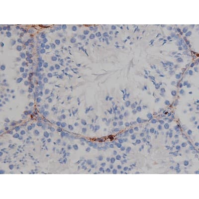 MAPT / Tau Antibody (phospho-Ser356)
